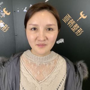 整形前后对比图片