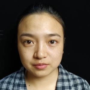 整形前后对比图片