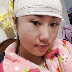 因为我爱你的整形术后图片