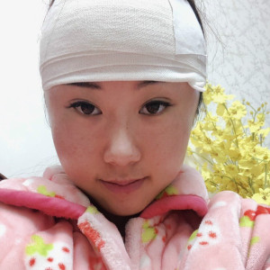 因为我爱你的整形术后图片