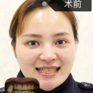 整形前后对比图片