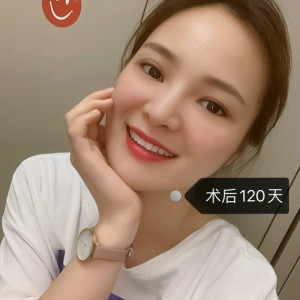 整形前后对比图片