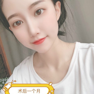 呵呵恩恩哦的整形术后图片