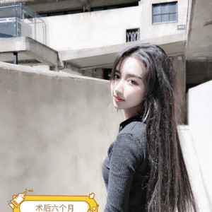 呵呵恩恩哦的整形术后图片