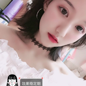 呵呵恩恩哦的整形术后图片