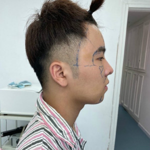 整形前后对比图片