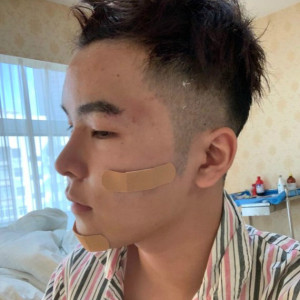 你不能忘的整形术后图片