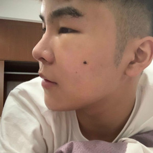 你不能忘的整形术后图片