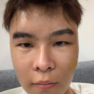 你不能忘的整形术后图片