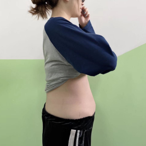 整形前后对比图片