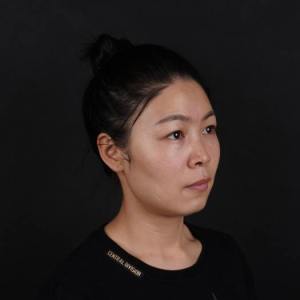 整形前后对比图片