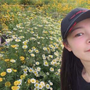 整形前后对比图片