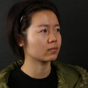 整形前后对比图片