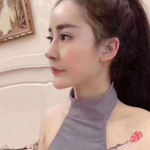 整形前后对比图片