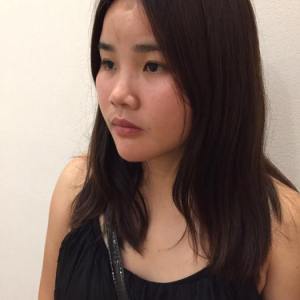 整形前后对比图片