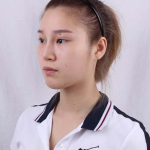 整形前后对比图片