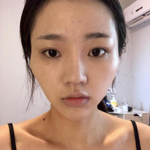 整形前后对比图片