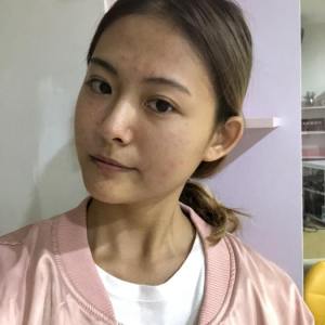 整形前后对比图片