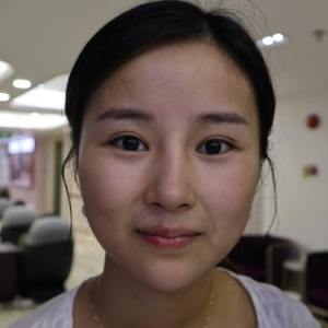 整形前后对比图片