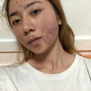 整形前后对比图片