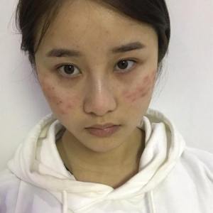 整形前后对比图片