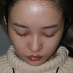 整形前后对比图片