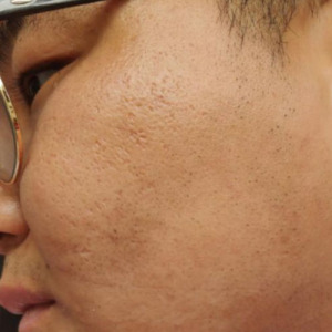 整形前后对比图片