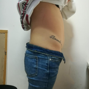 整形前后对比图片