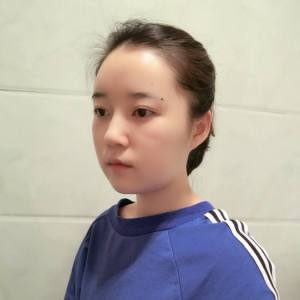 时间生个野种叫回忆的整形术后图片