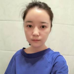 时间生个野种叫回忆的整形术后图片