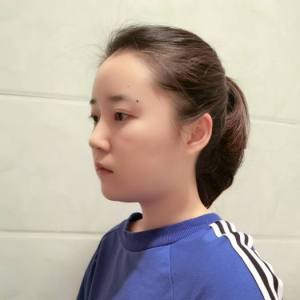 时间生个野种叫回忆的整形术后图片