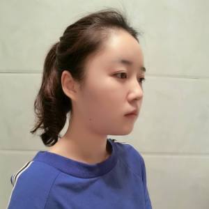 时间生个野种叫回忆的整形术后图片