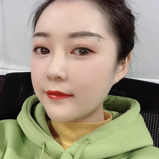 时间生个野种叫回忆的整形术后图片