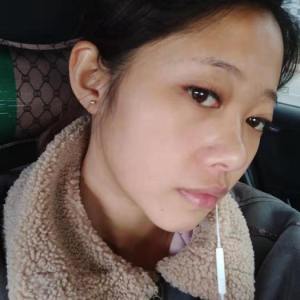 整形前后对比图片