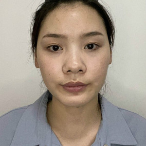 整形前后对比图片