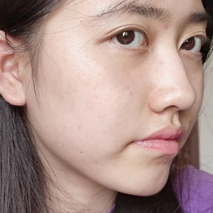 整形前后对比图片