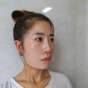 整形前后对比图片