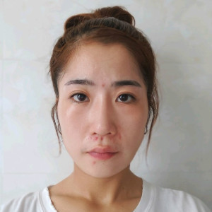 整形前后对比图片