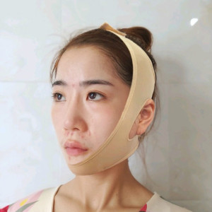 心静而欣的整形术后图片