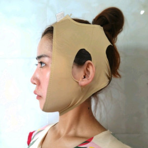 心静而欣的整形术后图片