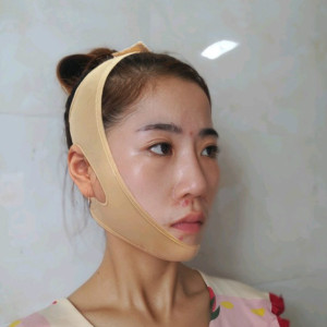 心静而欣的整形术后图片