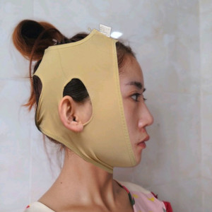 心静而欣的整形术后图片