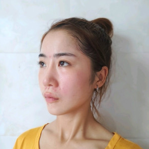 心静而欣的整形术后图片