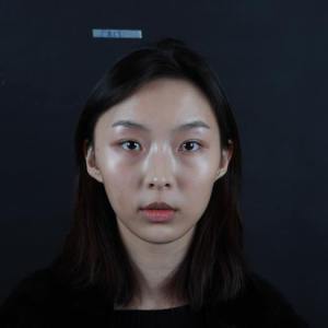 整形前后对比图片