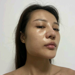 整形前后对比图片