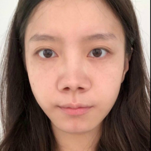 整形前后对比图片