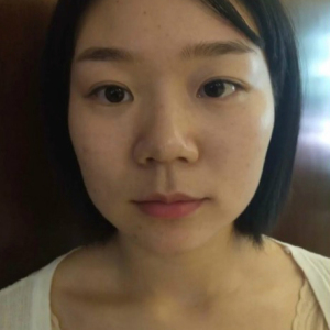 整形前后对比图片