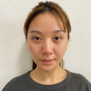 整形前后对比图片