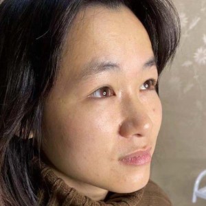 整形前后对比图片