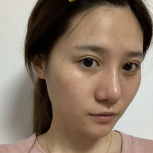 整形前后对比图片